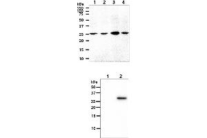 The cell lysates (40ug) were resolved by SDS-PAGE, transferred to PVDF membrane and probed with anti-human OSTF1 antibody (1:1000). (OSTF1 Antikörper)