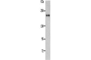 Western Blotting (WB) image for anti-Nephrosis 1, Congenital, Finnish Type (Nephrin) (NPHS1) antibody (ABIN2431713) (Nephrin Antikörper)