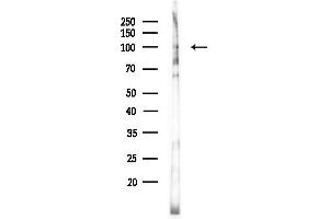 anti-Ribosomal Protein S6 Kinase A4 (RPS6KA4) (Internal Region) antibody