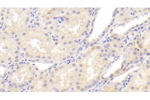 Detection of PCNT in Human Kidney Tissue using Polyclonal Antibody to Pericentrin (PCNT) (PCNT Antikörper  (AA 2987-3246))