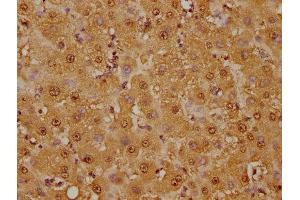 IHC image of ABIN7127533 diluted at 1:125 and staining in paraffin-embedded human liver tissue performed on a Leica BondTM system.