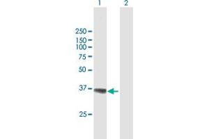 Western Blot analysis of AKR1A1 expression in transfected 293T cell line by AKR1A1 MaxPab polyclonal antibody. (AKR1A1 Antikörper  (AA 1-325))