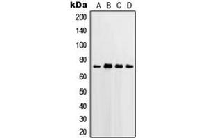 Western blot analysis of PGHS-2 expression in HeLa (A), Jurkat (B), Raw264. (PTGS2 Antikörper  (C-Term))