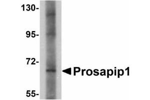 Image no. 1 for anti-ProSAP-Interacting Protein 1 (PROSAPIP1) (C-Term) antibody (ABIN478164) (ProSAPiP1 Antikörper  (C-Term))
