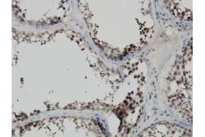 Image no. 1 for anti-PDZ Binding Kinase (PBK) (AA 1-110) antibody (ABIN599274) (PBK Antikörper  (AA 1-110))