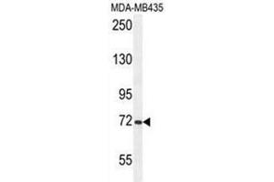 ARHGAP10 Antikörper  (Middle Region)