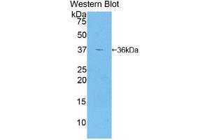 Detection of Recombinant GAD2, Human using Polyclonal Antibody to Glutamate Decarboxylase 2 (GAD2) (GAD65 Antikörper  (AA 65-105))