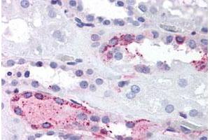 Immunohistochemical (Formalin/PFA-fixed paraffin-embedded sections) staining in human kidney with LPAR4 polyclonal antibody . (LPAR4 Antikörper  (C-Term))
