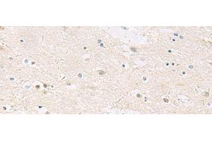 Immunohistochemistry of paraffin-embedded Human brain tissue using ANKS6 Polyclonal Antibody at dilution of 1:55(x200) (ANKS6 Antikörper)