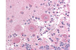 Anti-BCL2L14 / Bcl G antibody IHC of human brain, cerebellum. (BCL2L14 / BCL-G (C-Term) Antikörper)