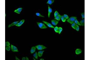 Immunofluorescence staining of Hela cells with ABIN7142520 at 1:100, counter-stained with DAPI. (RPS23 Antikörper  (AA 2-143))