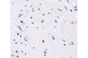 Used in DAB staining on fromalin fixed paraffin- embedded Kidney tissue (Arx Antikörper  (AA 25-246))