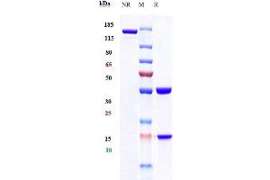 Anti-IFNg Reference Antibody (fontolizumab) on SDS-PAGE under reducing (R) condition. (Rekombinanter IFNG (Fontolizumab Biosimilar) Antikörper)