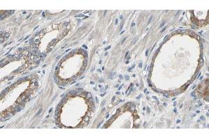 ABIN6277566 at 1/100 staining Human prostate tissue by IHC-P. (EEF2K Antikörper  (Internal Region))