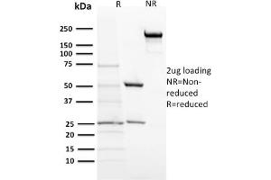 SDS-PAGE Analysis Purified ACTH Mouse Monoclonal Antibody (57). (POMC Antikörper  (N-Term))