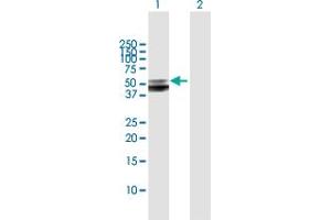 Western Blot analysis of SERPINA12 expression in transfected 293T cell line by SERPINA12 MaxPab polyclonal antibody. (SERPINA12 Antikörper  (AA 1-414))