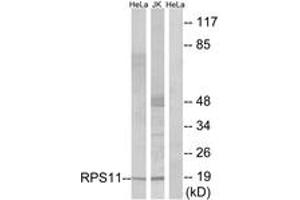 Western Blotting (WB) image for anti-Ribosomal Protein S11 (RPS11) (AA 71-120) antibody (ABIN2890060)