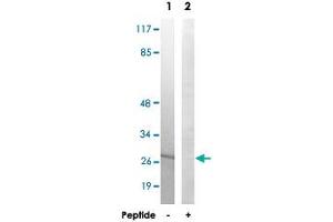 Western blot analysis of extracts from 293 cells, using MRPL16 polyclonal antibody . (MRPL16 Antikörper)