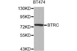 Western blot analysis of extracts of BT474 cell line, using BTRC antibody. (BTRC Antikörper  (AA 50-340))