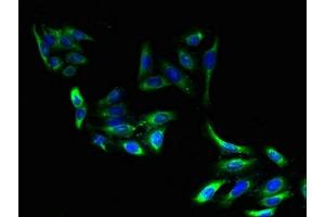 Immunofluorescent analysis of HepG2 cells using ABIN7151560 at dilution of 1:100 and Alexa Fluor 488-congugated AffiniPure Goat Anti-Rabbit IgG(H+L) (ELOVL2 Antikörper  (AA 91-174))