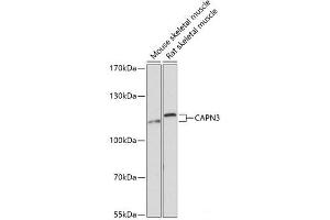 Western blot analysis of extracts of various cell lines using CAPN3 Polyclonal Antibody at dilution of 1:3000. (Calpain 3 Antikörper)
