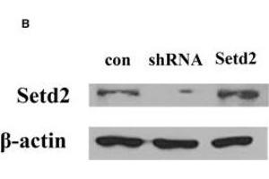 Western Blotting (WB) image for anti-SET Domain Containing 2 (SETD2) (AA 803-1103) antibody (ABIN1682666)