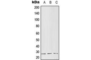 Western blot analysis of RGS5 expression in MCF7 (A), Raw264. (RGS5 Antikörper  (Center))