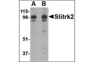 Western blot analysis of Slitrk2 in rat brain tissue lysate with this product at (A) 1 and (B) 2 μg/ml. (SLITRK2 Antikörper  (C-Term))