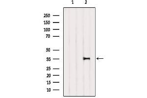 Western blot analysis of extracts from Mouse lung, using IkappaB-alpha Antibody. (NFKBIA Antikörper  (C-Term))