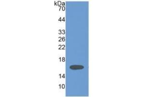 WB of Protein Standard: different control antibodies  against Highly purified E. (HPSE ELISA Kit)