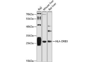 Western blot analysis of extracts of various cell lines, using HLA-DRB3 antibody (ABIN6131761, ABIN6141833, ABIN6141834 and ABIN6216072) at 1:1000 dilution. (HLA-DRB3 Antikörper  (AA 30-227))