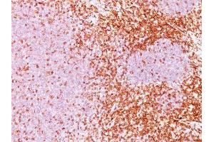 Image no. 1 for anti-CD6 (CD6) antibody (ABIN6160102) (CD6 Antikörper)