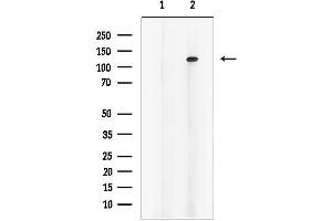 anti-alpha Ketoglutarate Dehydrogenase (alphaKGDHC) (N-Term) antibody