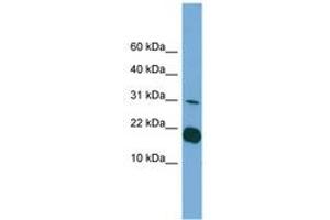 Image no. 1 for anti-Interleukin 1 delta (FIL1d) (C-Term) antibody (ABIN6745104) (FIL1d Antikörper  (C-Term))