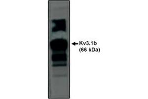 Image no. 1 for anti-Potassium Voltage-Gated Channel, Shaw-Related Subfamily, Member 1 (KCNC1) antibody (ABIN201687) (KCNC1 Antikörper)
