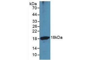 Western Blotting (WB) image for anti-ADAM Metallopeptidase with Thrombospondin Type 1 Motif, 1 (ADAMTS1) (AA 476-614) antibody (ABIN7426889)