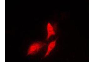 Immunofluorescent analysis of S6K1 staining in HeLa cells. (RPS6KB1 Antikörper  (C-Term))