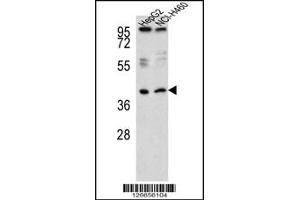 Western blot analysis of RSAD1 Antibody in HepG2,NCI-H460 cell line lysates (35ug/lane) (RSAD1 Antikörper  (C-Term))