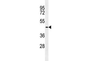 TMPRSS11E2 antibody western blot analysis in NCI-H292 lysate. (TMPRSS11E Antikörper  (AA 249-277))
