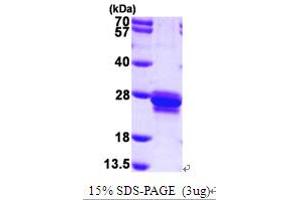 SDS-PAGE (SDS) image for Transgelin (TAGLN) (AA 1-201) protein (His tag) (ABIN667026) (Transgelin Protein (TAGLN) (AA 1-201) (His tag))