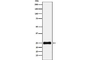 Western blot analysis of PSMA2 expression in HepG2 cell lysate.