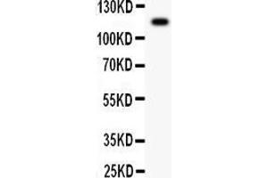 Anti- C5A antibody, Western blotting All lanes: Anti C5A  at 0. (C5 Antikörper  (AA 1-77))