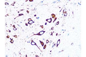 Immunohistochemistry of paraffin-embedded mouse spinal cord using FMRP Rabbit mAb (ABIN1679778, ABIN3019025, ABIN3019026 and ABIN7101703) at dilution of 1:100 (40x lens). (FMR1 Antikörper)