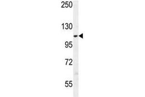 Western Blotting (WB) image for anti-Alanyl-tRNA Synthetase 2, Mitochondrial (AARS2) (AA 366-394) antibody (ABIN3028457)