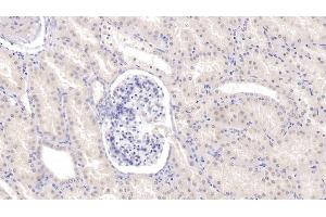 Detection of Tie1 in Human Kidney Tissue using Monoclonal Antibody to Tyrosine Kinase With Immunoglobulin Like And EGF Like Domains Protein 1 (Tie1) (TIE1 Antikörper  (AA 435-609))