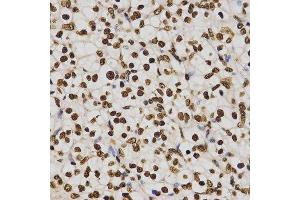 Immunohistochemistry (Paraffin-embedded Sections) (IHC (p)) image for anti-Histone H4 (3meLys20) antibody (ABIN3016051)