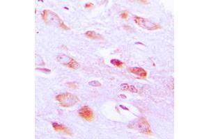 Immunohistochemical analysis of AKT2 staining in human brain formalin fixed paraffin embedded tissue section. (AKT2 Antikörper  (C-Term))