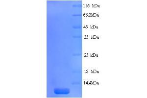 SDS-PAGE (SDS) image for Amyloid P Component, Serum (APCS) (AA 1-81), (full length) protein (His tag) (ABIN5713762) (APCS Protein (AA 1-81, full length) (His tag))