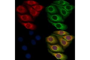 ABIN7093376 and ABIN7097396 staining Hela cells by IF/ICC. (MAP3K3 Antikörper)