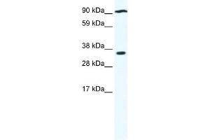 PARP16 antibody used at 0.